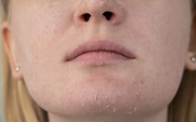 La importancia de hidratar tu rostro